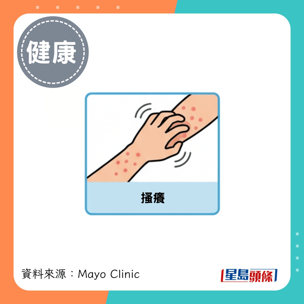 搔痒